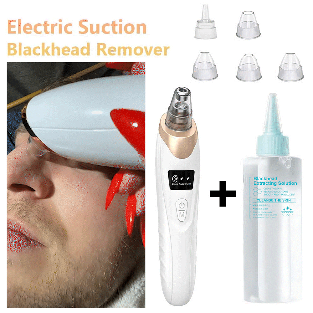 Electric Pore Vacuum & Blackhead Remover – Rechargeable Spot Extractor Tool Set
