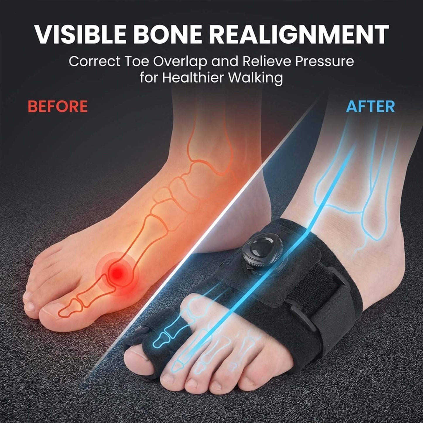 🦶 Support Better Toe Alignment  Adjustable bunion support for daily foot comfort.