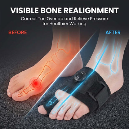 🦶 Support Better Toe Alignment  Adjustable bunion support for daily foot comfort.