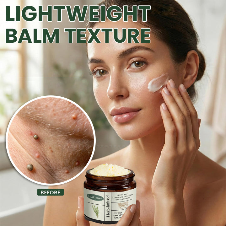 Bee Venom Handmade Premium Tallow Balm – Herb-Infused Eczema Therapy Cream