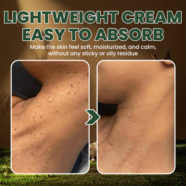 Bee Venom Handmade Premium Tallow Balm – Herb-Infused Eczema Therapy Cream