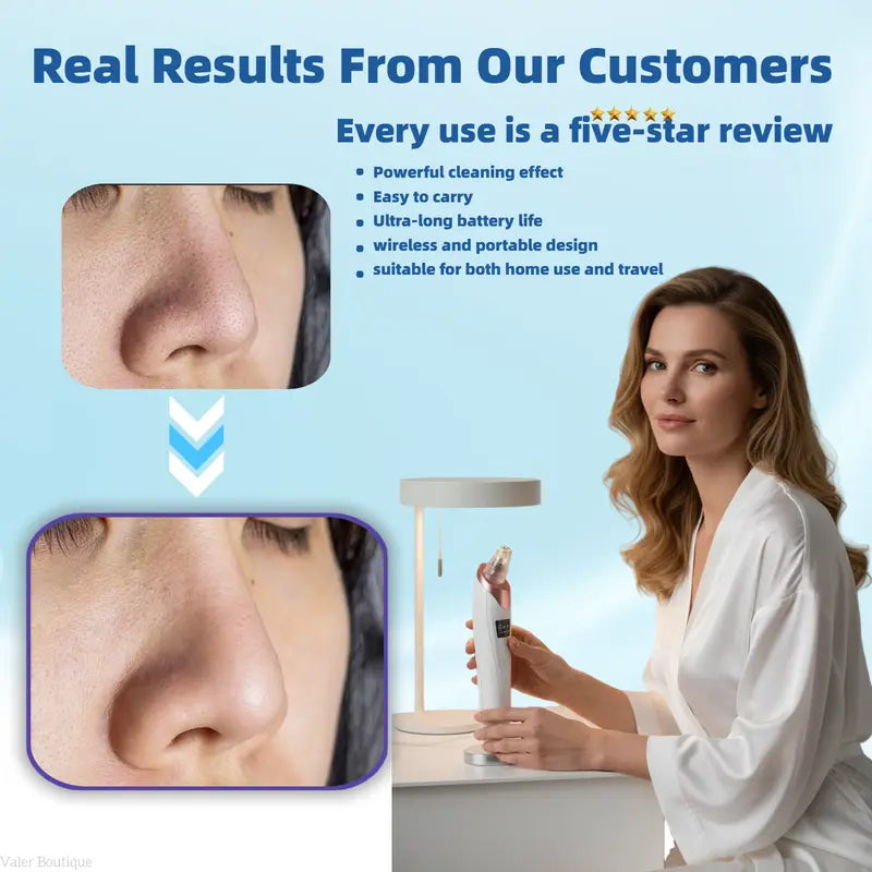 Electric Pore Vacuum & Blackhead Remover – Rechargeable Spot Extractor Tool Set