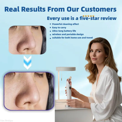 Electric Pore Vacuum & Blackhead Remover – Rechargeable Spot Extractor Tool Set