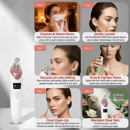 Electric Pore Vacuum & Blackhead Remover – Rechargeable Spot Extractor Tool Set